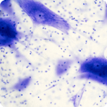 Nattokinase(NSK-SD®)